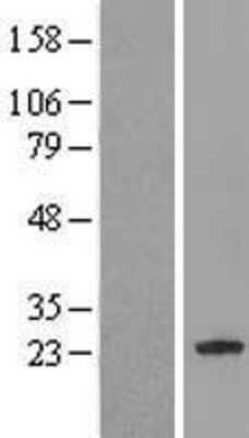 Western Blot: C7orf61 Overexpression Lysate [NBL1-12606]