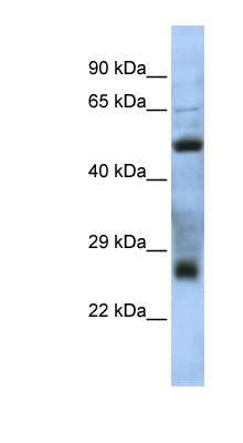 Western Blot: TEX47 Antibody [NBP1-70480]