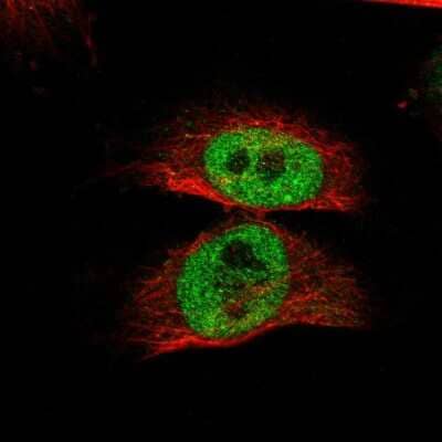 Immunocytochemistry/ Immunofluorescence: RBM48 Antibody [NBP1-84150]