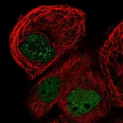 Immunocytochemistry/ Immunofluorescence: RBM48 Antibody [NBP1-85077]