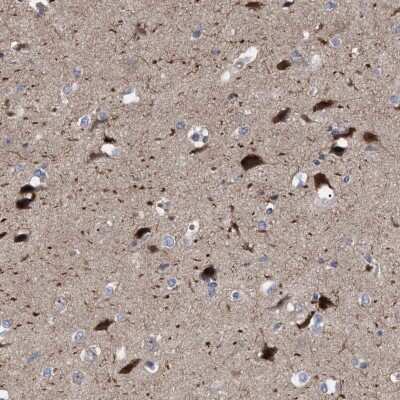 Immunohistochemistry-Paraffin: RBM48 Antibody [NBP1-84150]