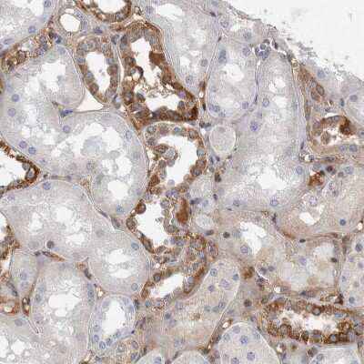 Immunohistochemistry-Paraffin: RBM48 Antibody [NBP1-85077]
