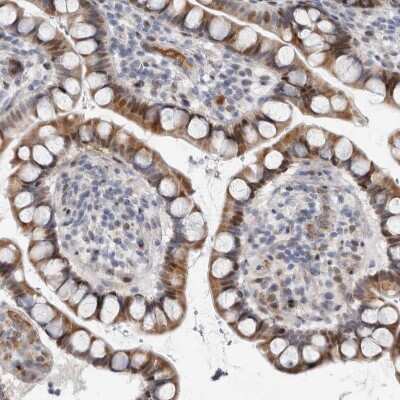 Immunohistochemistry-Paraffin: RBM48 Antibody [NBP1-85077]