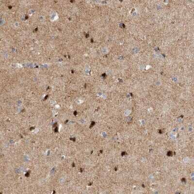 Immunohistochemistry-Paraffin: RBM48 Antibody [NBP1-85077]