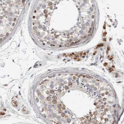 Immunohistochemistry-Paraffin: RBM48 Antibody [NBP1-85077]