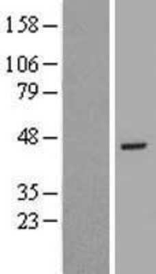 Western Blot: RBM48 Overexpression Lysate [NBL1-09898]