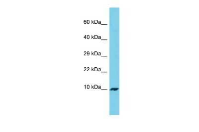 Western Blot: C7orf69 Antibody [NBP3-10732]