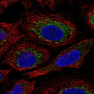 Immunocytochemistry/ Immunofluorescence: STMP1 Antibody [NBP2-56550]