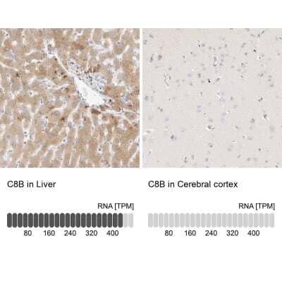 Immunohistochemistry-Paraffin: C8B Antibody [NBP1-85990]