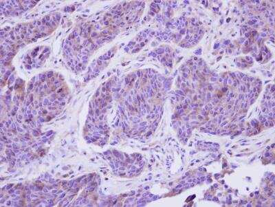 Immunohistochemistry-Paraffin: C8B Antibody [NBP2-15651]