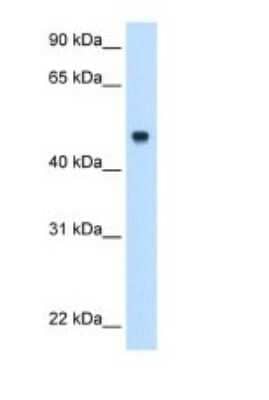 Western Blot: C8B Antibody [NBP1-70481]