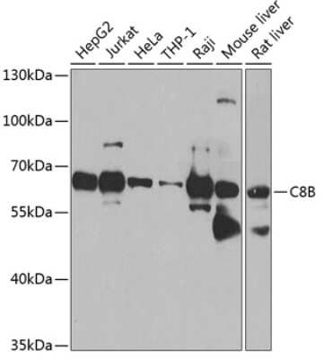 Western Blot: C8B AntibodyBSA Free [NBP2-92538]