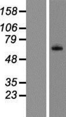 Western Blot: C8B Overexpression Lysate [NBP2-09058]