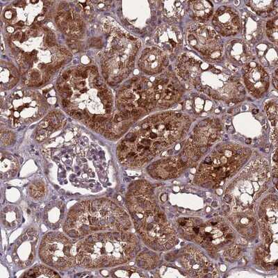 Immunohistochemistry-Paraffin: C8G Antibody [NBP2-14422]