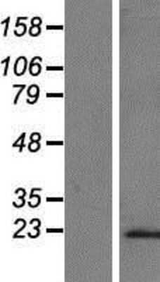 Western Blot: C8G Overexpression Lysate [NBP2-09007]