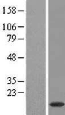 Western Blot: PPDPFL Overexpression Lysate [NBL1-08564]