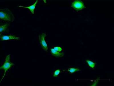 Immunocytochemistry/ Immunofluorescence: C8orf33 Antibody [H00065265-D01P]