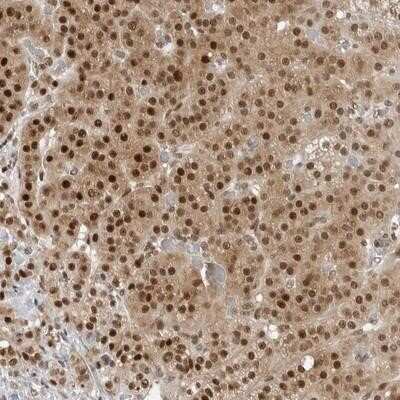 Immunohistochemistry-Paraffin: C8orf33 Antibody [NBP1-82155]