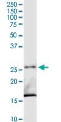 Western Blot: C8orf33 Antibody [H00065265-D01P]