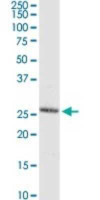 Western Blot: C8orf33 Antibody [H00065265-D01P]