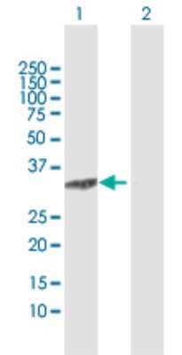 Western Blot: C8orf33 Antibody [H00065265-D01P]