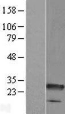 Western Blot: C8orf33 Overexpression Lysate [NBL1-08566]