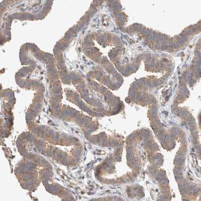 Immunohistochemistry-Paraffin: C8orf37 Antibody [NBP1-93892]