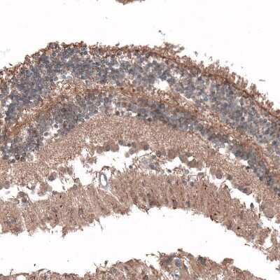 Immunohistochemistry-Paraffin: C8orf37 Antibody [NBP1-93892]