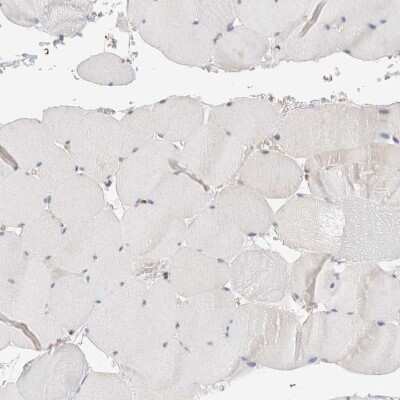 Immunohistochemistry-Paraffin: C8orf37 Antibody [NBP1-93892]