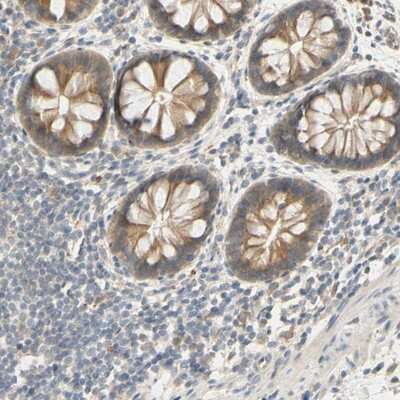 Immunohistochemistry-Paraffin: SMIM19 Antibody [NBP1-89554]