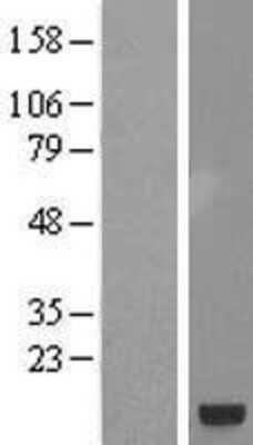 Western Blot: SMIM19 Overexpression Lysate [NBL1-08568]