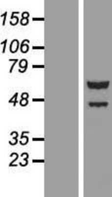 Western Blot: TTI2 Overexpression Lysate [NBL1-08569]