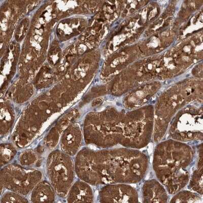 Immunohistochemistry-Paraffin: TTI2 Antibody [NBP1-82085]