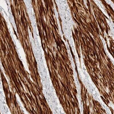 Immunohistochemistry-Paraffin: TTI2 Antibody [NBP1-82086]
