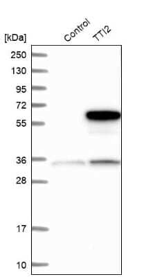 Western Blot: TTI2 Antibody [NBP1-82085]