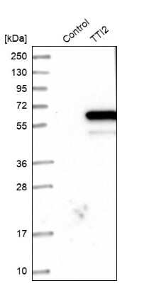 Western Blot: TTI2 Antibody [NBP1-82086]