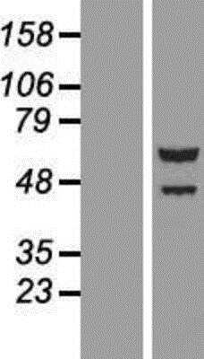 Western Blot: TTI2 Overexpression Lysate [NBP2-09342]