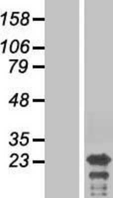 Western Blot: Testis Development Related Protein Overexpression Lysate [NBP2-05078]