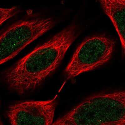 Immunocytochemistry/ Immunofluorescence: C8orf44 Antibody [NBP2-55571]