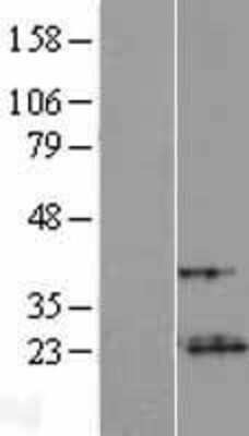 Western Blot: VXN Overexpression Lysate [NBL1-08572]