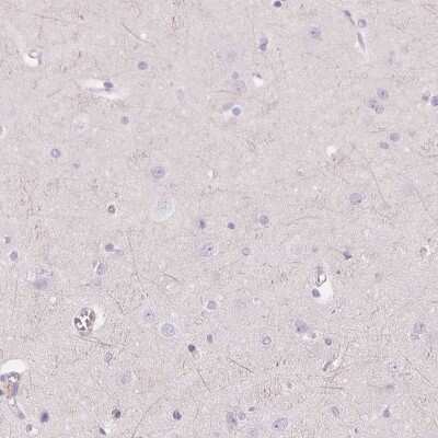 Immunohistochemistry-Paraffin: Glutamate Rich 5 Antibody [NBP1-93788]