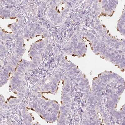 Immunohistochemistry-Paraffin: Glutamate Rich 5 Antibody [NBP1-93789]