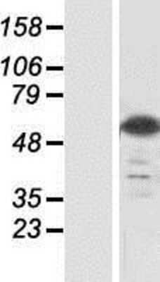 Western Blot: Glutamate Rich 5 Overexpression Lysate [NBP2-05114]