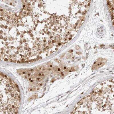 Immunohistochemistry: C8orf48 Antibody [NBP1-93919]