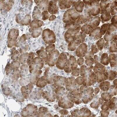 Immunohistochemistry-Paraffin: C8orf48 Antibody [NBP1-93916]