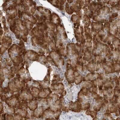 Immunohistochemistry-Paraffin: C8orf48 Antibody [NBP1-93918]