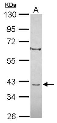 Western Blot: C8orf48 Antibody [NBP2-15652]