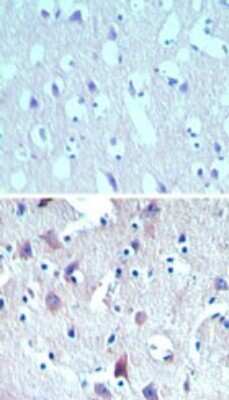 Immunohistochemistry-Paraffin: THEM6 Antibody [NBP2-24492]