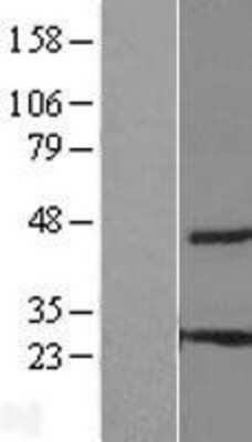 Western Blot: THEM6 Overexpression Lysate [NBL1-08574]