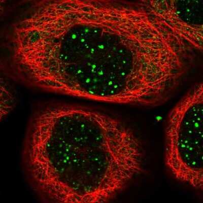 Immunocytochemistry/ Immunofluorescence: C8orf58 Antibody [NBP1-93836]